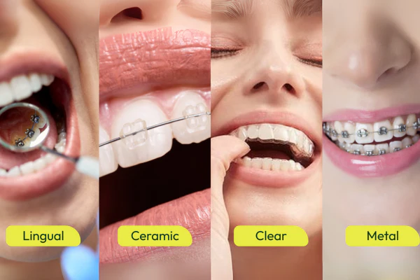 Teenager with braces smiling